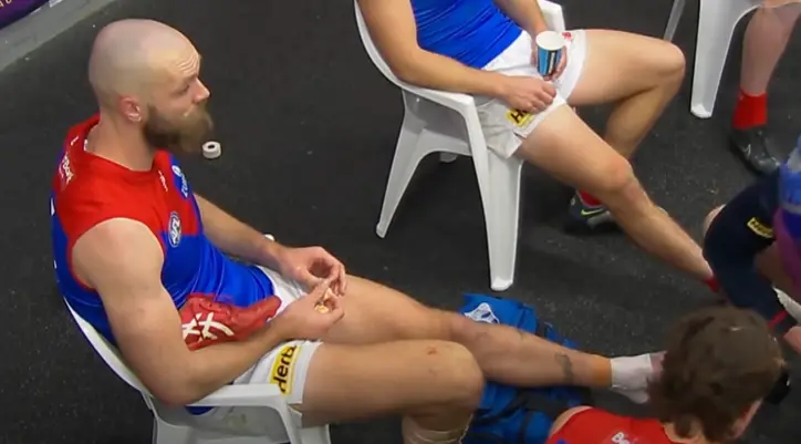 Max Gawn injury